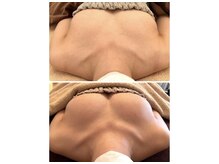 美人バスト 静岡店/バストアップ症例