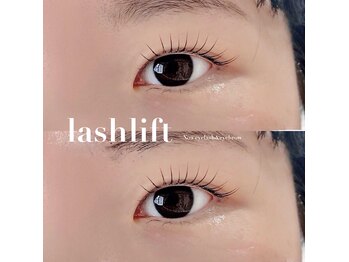 ノア(NOA)/自然な仕上がり