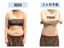 ビオラス 太田藤阿久店/そのたるみ諦めないで！！