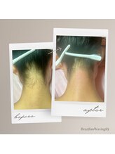 ブラジリアンワキシング シックスナイン(BrazilianWaxing69)/女性 / うなじ