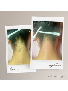 ブラジリアンワキシング シックスナイン(BrazilianWaxing69)/女性 / うなじ