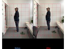 リード整骨院(LEAD整骨院)/姿勢改善、猫背、反り腰