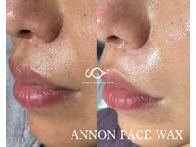 SOY. eyebrow and beauty salon【ソイ】の雰囲気（産毛と古い角質をオフして、触れたくなる素肌へ）