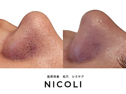 ニコリ(NICOLI)の写真