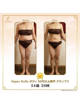 リンカ(Rinka.)/☆帯広初!!ハイパーナイフ導入☆