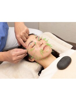 鍼灸施術を受けたい