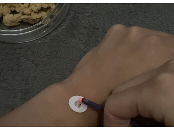 あくび 西麻布(aqu美)/お灸