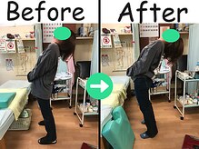 杉本接骨鍼灸院/産後の骨盤矯正が10回で卒業