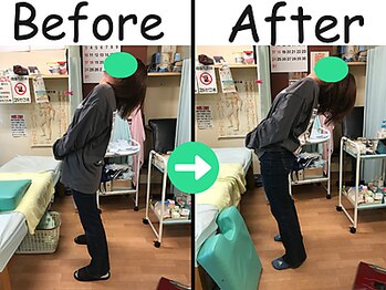 杉本接骨鍼灸院/産後の骨盤矯正が10回で卒業
