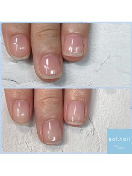 エオル(eol.)/自爪育成☆深爪緩和☆フィルイン