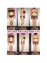 シェイプ 浜松本店/1回でも効果実感シェイプ浜松