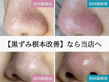 ティーツリー(Tea Tree)の写真