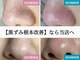 ティーツリー(Tea Tree)の写真