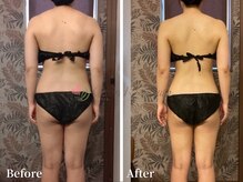 ワールドビューティー(World Beauty)/脂肪ゼロ◆本格痩身ダイエット