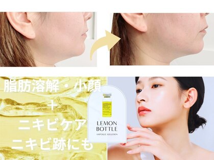 ココンフワット(Coconfouato)の写真