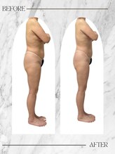 アンドエム(&M)&nbsp;チノザ メソッド