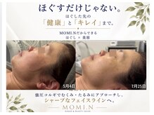 モミン(MOMI.N)の雰囲気（首肩コリからくるたるみを改善。施術後はスッキリした骨格に♪）
