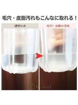 ビーフィール 府中店(be feel)/毛穴の汚れがこんなに！