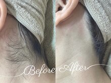 エステ ド モモコ/美肌脱毛プラン