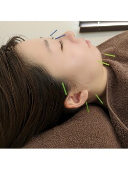 コンディショニングサロン クーラ(CURA)/美容鍼灸
