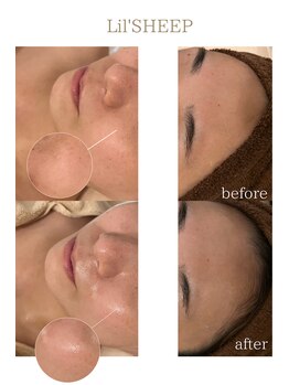 リルシープ(LIL'SHEEP)/陶肌ピール