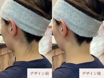 クラームビューティー(Clerm beauty)/美容師によるうなじデザイン脱毛
