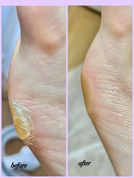 ラヴィ(La vie)/靴履く時に引っかかる