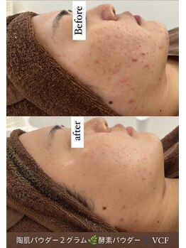 ルヴィ 浦添店(REVI)/