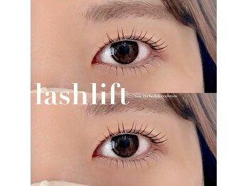 ノア(NOA)/ラッシュリフト（上下）