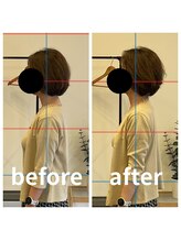 熊本カワル整体 JR上熊本駅院/ストレートネック