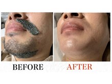 メンズブリリアンス/★ヒゲＷＡＸ★