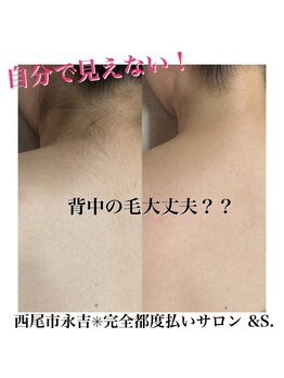 アンドエス(&S.)/まるっと全身美肌脱毛がお得◎