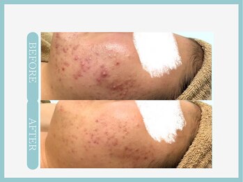 スリムライン 盛岡店(The Slim Line)/before→after