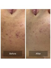 ビジュープラス 筑西下館店(Bijou+)/