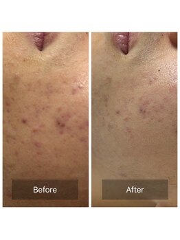 ビジュープラス 筑西下館店(Bijou+)/