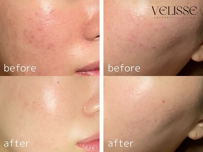 ヴェリス 新宿店(Velisse)の写真