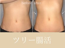 チャームズ(CHARM'S)/ツリー腸活★