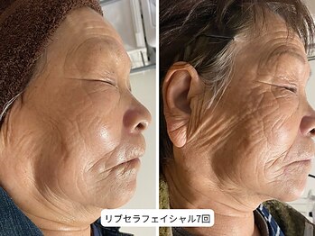 サロン アンネ(Anne)/リブセラ