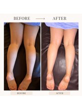 ブリリアントスマイル/太ももお尻痩せに与那原の痩身