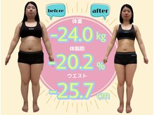 30代、本格的ダイエットコース‐24キロ痩せ！着ることができなかったあの服がまた着れるようになりました。