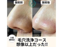 リッカロッカ(RIKKA&ROCCA)/想像以上の結果