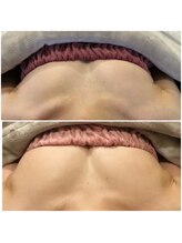 サチ(Sachi)/生理はもうないんですが、、