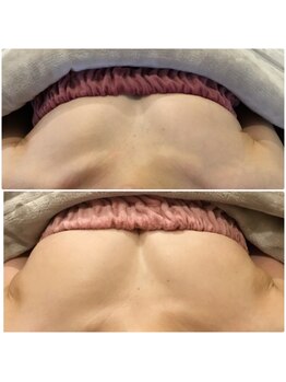 サチ(Sachi)/生理はもうないんですが、、