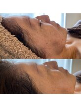 シグネット(Cygnet)/CHRISTINA/イラストリアス