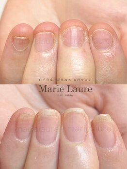マリーロール 天王寺店(Marie Laure)/深爪改善/自爪育成/ネイルケア
