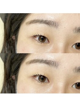 エムプラス(m+.)/瞼厚めの方もご相談ください♪
