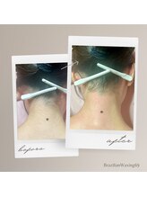 ブラジリアンワキシング シックスナイン(BrazilianWaxing69)/女性 / うなじ