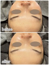 ニュイ(nuit)/初めてララピール