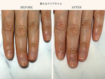 整えるクリアネイル