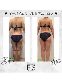 プライマルビューティ 艶 本店(Primal Beauty)/EｘS下半身　ビフォーアフター